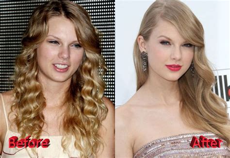 taylor swift breast surgery|Taylor Swift Was Slammed With Plastic Surgery Rumors .